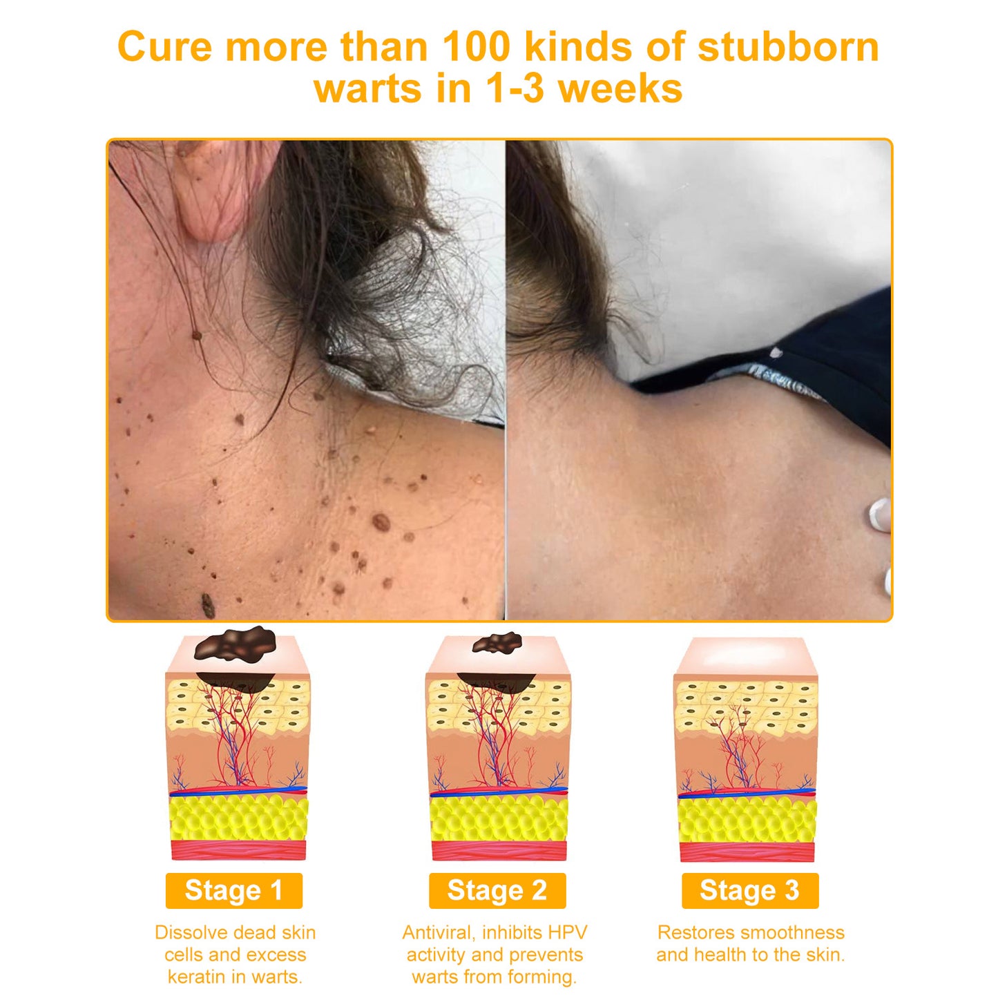 VLSVLS™ Bee Venom Skin Restoration Cream  (🥇2025 Readers' Choice Award Winner ＆ 👨‍⚕️AAD Recommended) 🐝