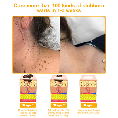 VLSVLS™ Bee Venom Skin Restoration Cream  (🥇2025 Readers' Choice Award Winner ＆ 👨‍⚕️AAD Recommended) 🐝