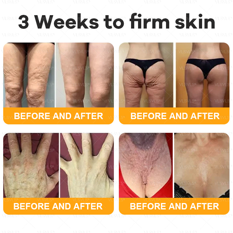 Made and Shipped from USA ✨ VLSVLS® Bee Venom Skin Restoration Cream 🔥 LAST DAY 80% OFF 💎💎