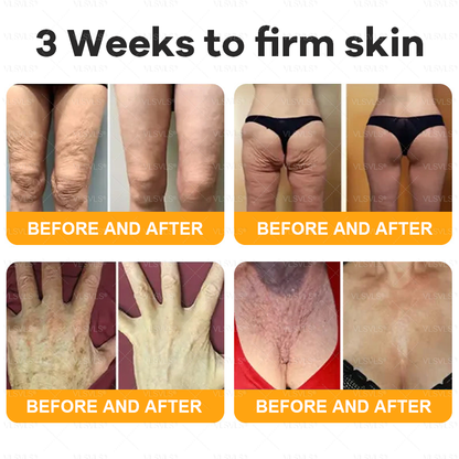 Made and Shipped from USA ✨ VLSVLS® Bee Venom Skin Restoration Cream 🔥 LAST DAY 80% OFF 💎💎