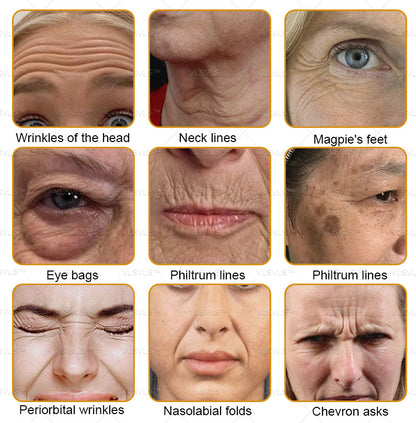 Mayo Clinic Official: VLSVLS™ Bee Venom Skin Restoration Cream, Anti-aging, Hydrating, Skin Repair, Even Tone, Acne and Dark Spot Treatment, Wart and Mole Removal, Psoriasis Relief🥇🥇