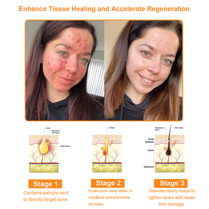 VLSVLS™ Bee Venom Skin Restoration Cream  (🥇2025 Readers' Choice Award Winner ＆ 👨‍⚕️AAD Recommended) 🐝
