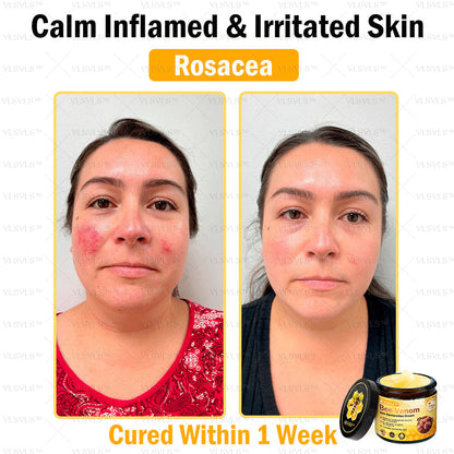 🐝🎁 Only 5 boxes left! We are offering you an additional 50% discount! Get yourself the perfect skin. If you miss it now, you won't get it until next year.