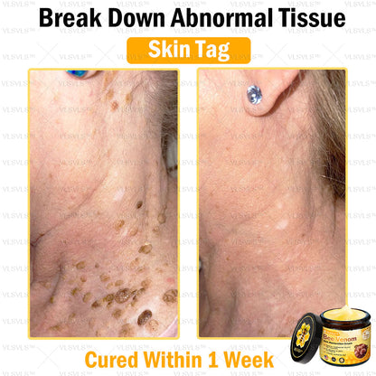 🐝🎁 Only 5 boxes left! We are offering you an additional 50% discount! Get yourself the perfect skin. If you miss it now, you won't get it until next year.