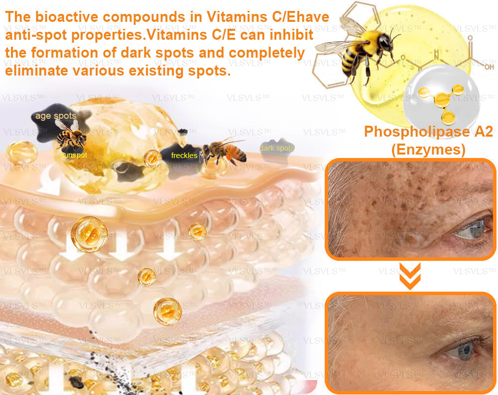 VLSVLS™ Bee Venom Skin Restoration Cream  (🥇2025 Readers' Choice Award Winner ＆ 👨‍⚕️AAD Recommended) 🐝